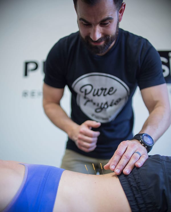 Dry Needle Therapy Strongsville Oh